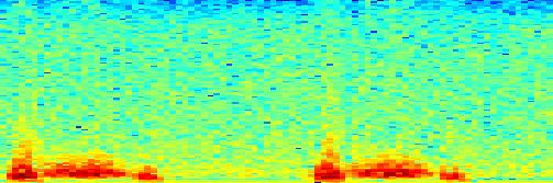 Frequency Aortální stenóza.2.1 -.1 -.2.1.2.3.4.5.6.7.8.