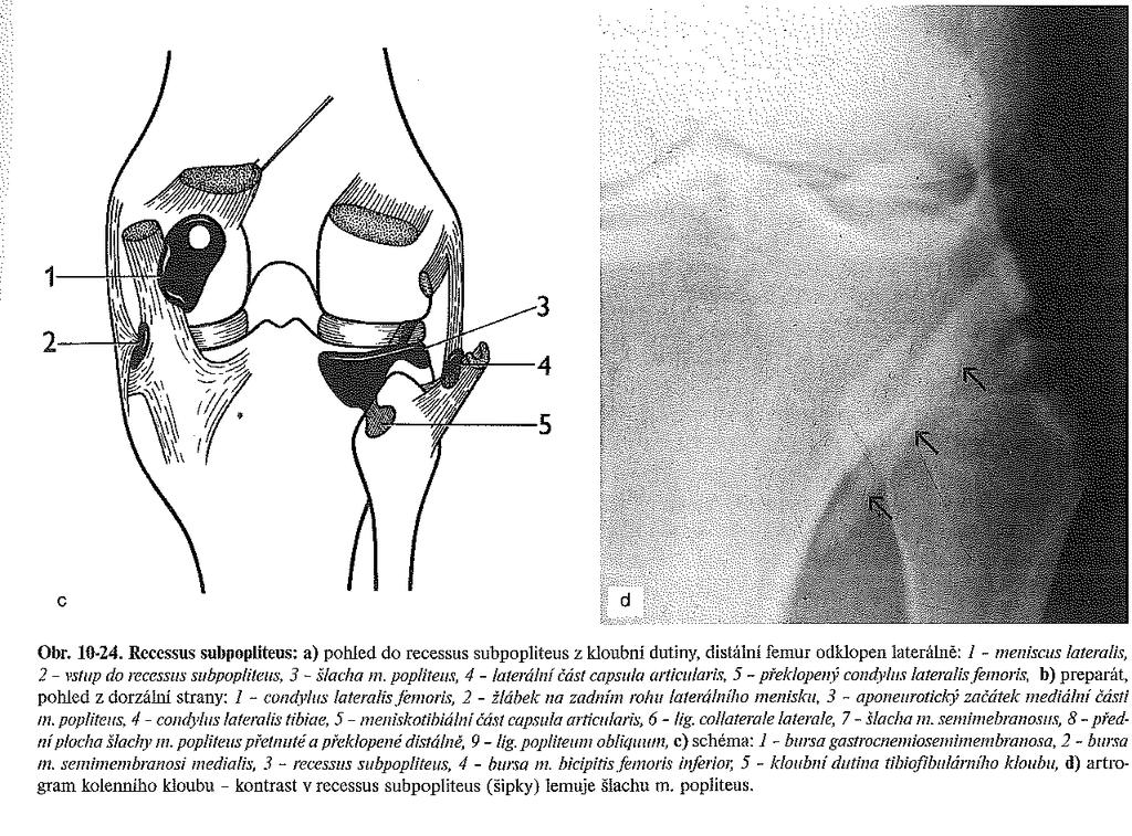 collaterale laterale, 7 - šlacha m. biceps femoris, - meniscus lateralis, 9 - posteromediální část lig. cruciatum posterior, 1 - anterolaterální část lig.