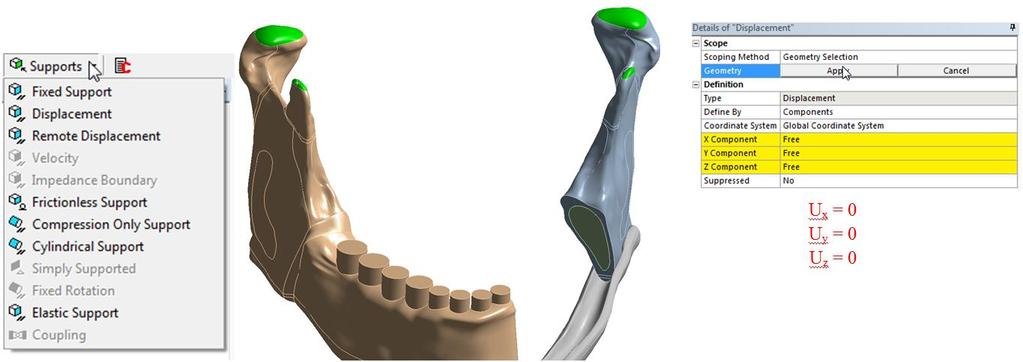 Okrajové podmínky byly předepsány stejné jako v klasickém prostředí ANSYS: nulové posuvy v horní oblasti kondylu a coronoidu.