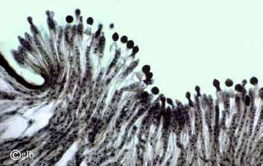 Zygomycota Entomophthoromycotina - obligátní parazité