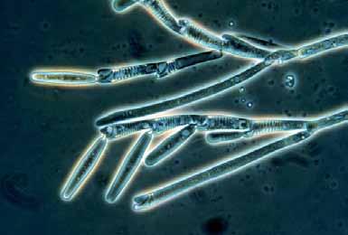 trichospor s nepohyblivými přívěsky na konci - dříve skupina nazývána Trichomycetes - Genistelloides,