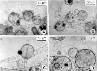 Chromista Hyphochytriomycota - buněčná stěna s celulózou a chitinem - holokarpická a eukarpická stélka se zoosporangii - zoospory jeden apikální bičík - parazité vodních řas,