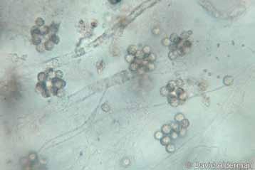Chromista Peronosporomycota (Oomycota, řasovky) Aphanomyces astaci - původce račího