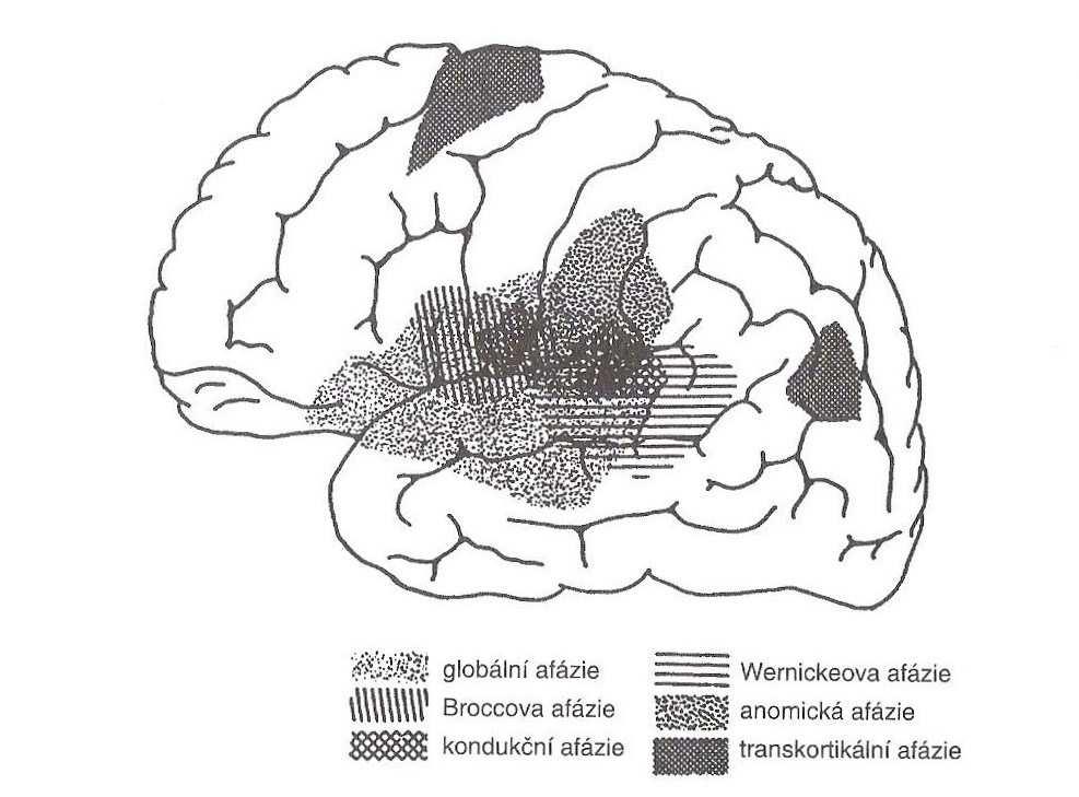 2007, s. 54) Lokalizační schéma laterálního pohledu na levou mozkovou hemisféru (viz obr. č.