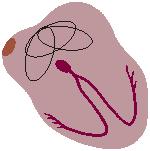 Fibrilace síní ATRIAL FIBRILLATION Impuses have chaotic, random