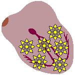 Fibrilace komor VENTRICULAR FIBRILLATION Chaotic