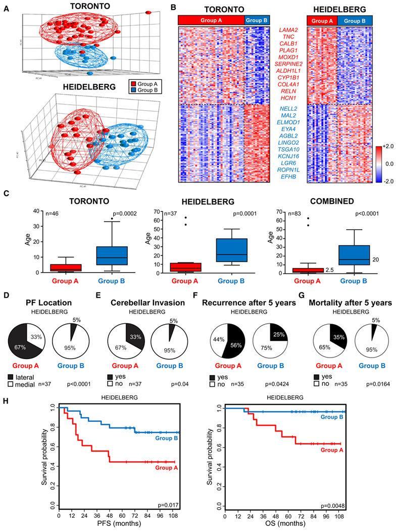 Molekulární / prediktivní neuropatologie EPENDYMOMU Witt H et al.