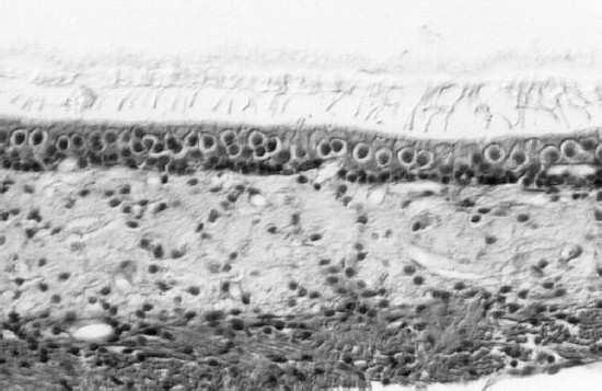 Statolitová (otolitová) membrána v sakulu cellbio.
