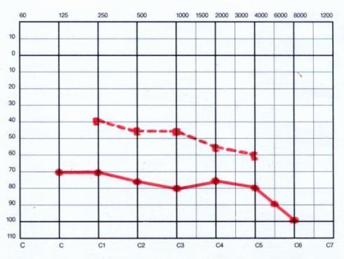 V 10 3 Vs 10 W R + prod. Sch norm.