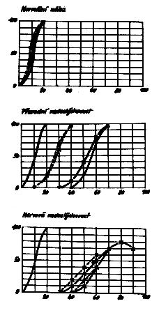 Slovní audiometrie Vyšetřovaný opakuje přehrávaná slova.