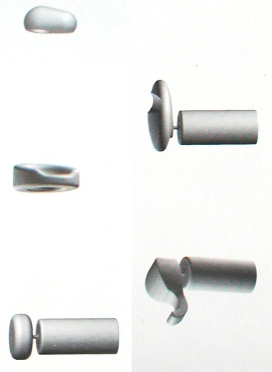 PORP partial ossicular