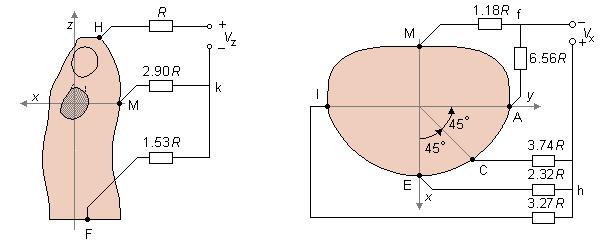 Obrázek 7: Rozmístění elektrod Frankova systému. 1.3 EKG křivky vybraných patologií srdce 1.3.1 Arytmie Flutter síní Literatura [2] a [4] uvádí, že pro flutter síní jsou typické pilovité kmity (vlny F), jsou patrné ve svodech II, III a avf.