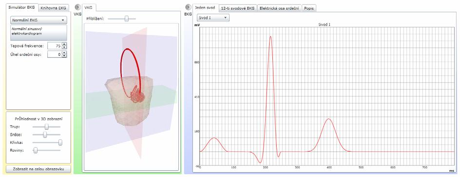 Obrázek 29: Internetová aplikace EKG2009 předvádějící fyziologické a patologické křivky EKG a VKG. Obrázek 30: Zdroje EKG signálu.