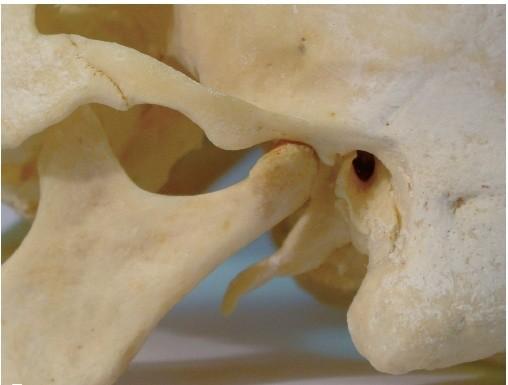 LPT Temporomandibulární kloub MPT Fossa condylaris (úsečky), condylus mandibulae (MC),