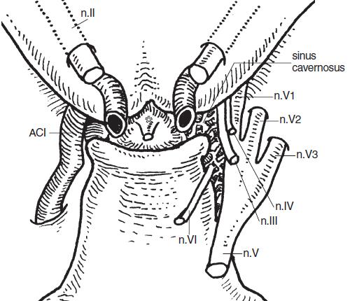 Basis