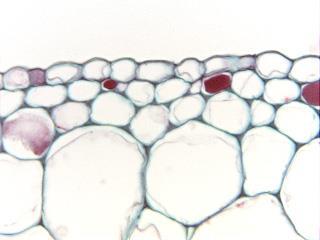 Angular collenchyma in