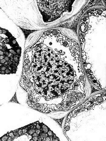 Angular collenchyma Apium