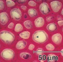 collenchyma