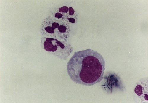 Obrázek 18: Plasmocyt,