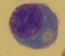 Aktivované monocyty s pohlceným materiálem se nazývají makrofágy. Podle fagocytovaného materiálu lze rozlišit různé typy, např. erytrofágy, hemosiderofágy, lipofágy apod.