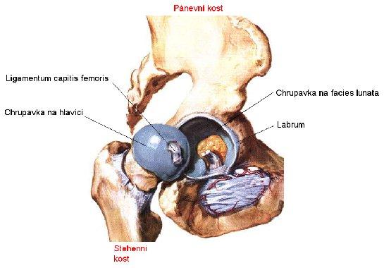 adolescentinum Coxa vara congenita Poškození kyčle v