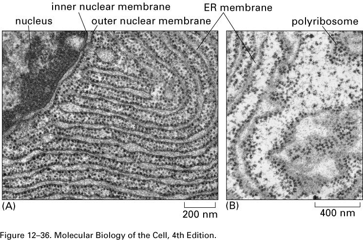 TEM of rough endoplasmic reticulum (RER). Extensive cellular network of membranes.
