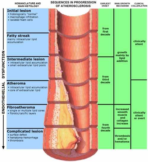 Obrázek 6: Vývoj aterosklerózy. www.healthyfellow.com/144/vitamin-c-deficiency/ (22. 4. 2010) 3.4 Typy aterosklerotických plátů Rozlišujeme pláty stabilní a nestabilní (1).