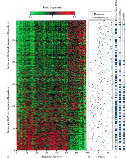 Budoucnost patologie Genetická klasifikace nádorů van de Vijver MJ et al: A