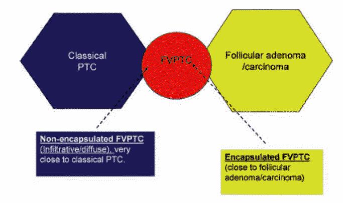 Folikulární varianta PC Morfologie PC (jádra) i FA/FC (folikly, pouzdro) Genetika PC (RET/PTC, BRAF) i FA/FC (k-ras, PAX8- PPARgamma) Variabilní chování Liu J,