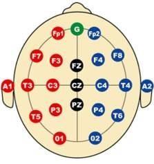 Elektrická aktivita mozku z povrchu skalpu se registruje pomocí speciálních EEG čepic vyrobených z pružné tkaniny.