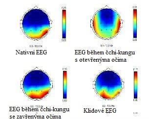 Obr. 3.5 Frekvenční BM v pásmu alfa pro etapy: 1. nativní EEG, 2. čchi-kung s otevřenýma očima, 3. čchi-kungu se zavřenýma očima, 4. klidové EEG se zavřenýma očima proband 2 3.3.1.3 Proband 3 Žena, 45 let, pracuje jako manager ve velké obchodní firmě.