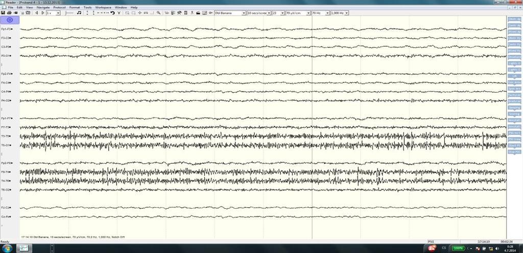Obr. 3.8 Nativní EEG před cvičením čchi-kungu proband 4 Graf 3.