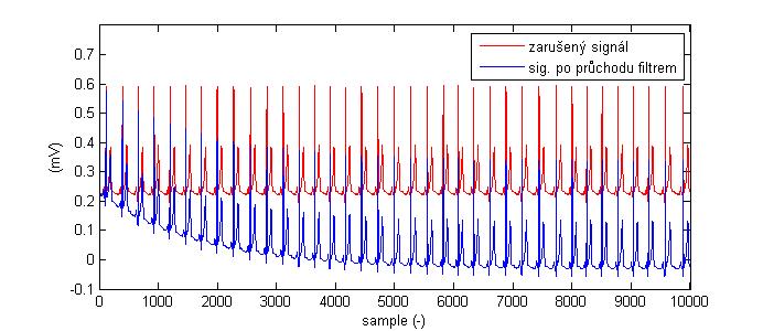 Při analýze IIR filtru byl použit záznam EKG signálu o časové délce signálu 20 sec.