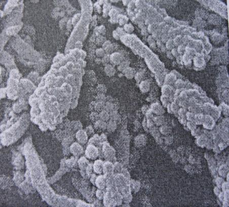 mikrokolonie kokoidních mikrobů, na něž při povrchu plaku nasedají tyčinky až vlákna Tři týdny převaha