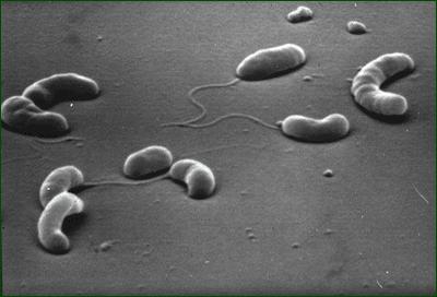 Vibrio cholerae http://www.cs.dartmouth.