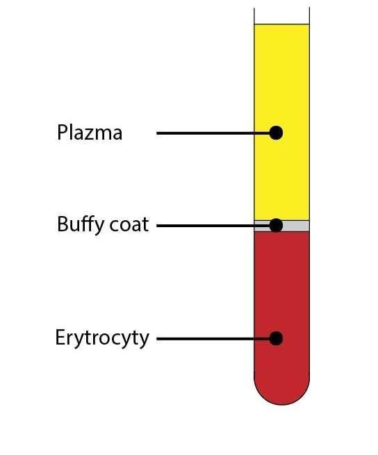 FORMOVANÉ KREVNÍ ELEMENTY 55% 1% 44% Leukocyty 4,5-11 10 3 / l neutrofily 71% eosinofily 3%