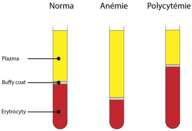 HEMATOKRIT Podíl objemu erytrocytů a objemu plné