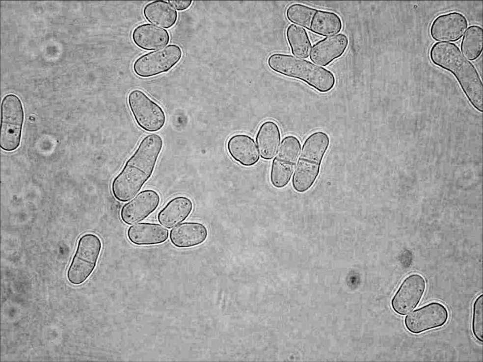 Saccharomyces cerevisiae a jejich pozorování pomocí optického mikroskopu Taxonomické zařazení: Ascomycetes Buňky S. cerevisiae jsou elipsoidní i kulovité, velké 5-10 mikrometrů.