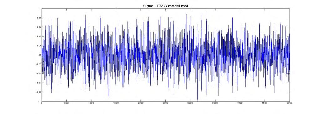 jednotlivá pásma v úsecích mezi R vlnami. Po prahování jsme provedli inverzní DTWT a z výsledného signálu vypočítali SNR pro jednotlivé metody pomocí vzorce (5.1).
