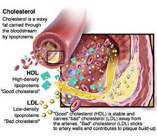 Cholesterol High-density lipoprotein (HDL) Intermediante-density lipoprotein (IDL) Low-density lipoprotein