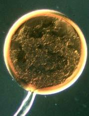arbuskulus, chlamydospora Oddělení: GLOMEROMYCOTA Třída: GLOMEROMYCETES recentně až na úrovni samostatného oddělení jsou hodnoceny houby z dřívějšího řádu