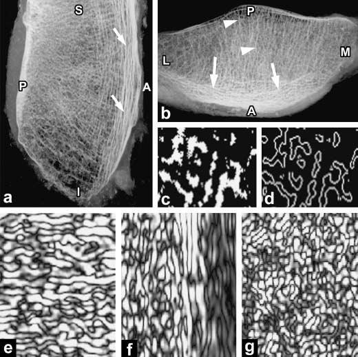 Odkaz na formativní vliv funkce na strukturu lze nalézt i díky radiologickým a histologickým studiím o architektuře kostní hmoty pately (např. Toumi a kol. 2006).