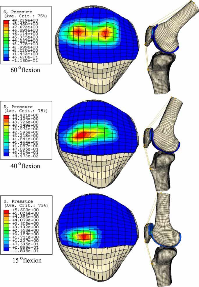 v průběhu pohybu do flexe. Data pro zpracování 2D dynamického modelu kolenního kloubu včetně ligament, svalů, kloubních ploch s povrchy, byla získána z kadaverů.