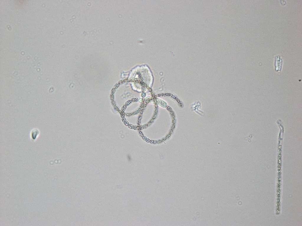 Anabaena