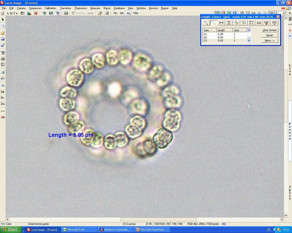 Anabaena