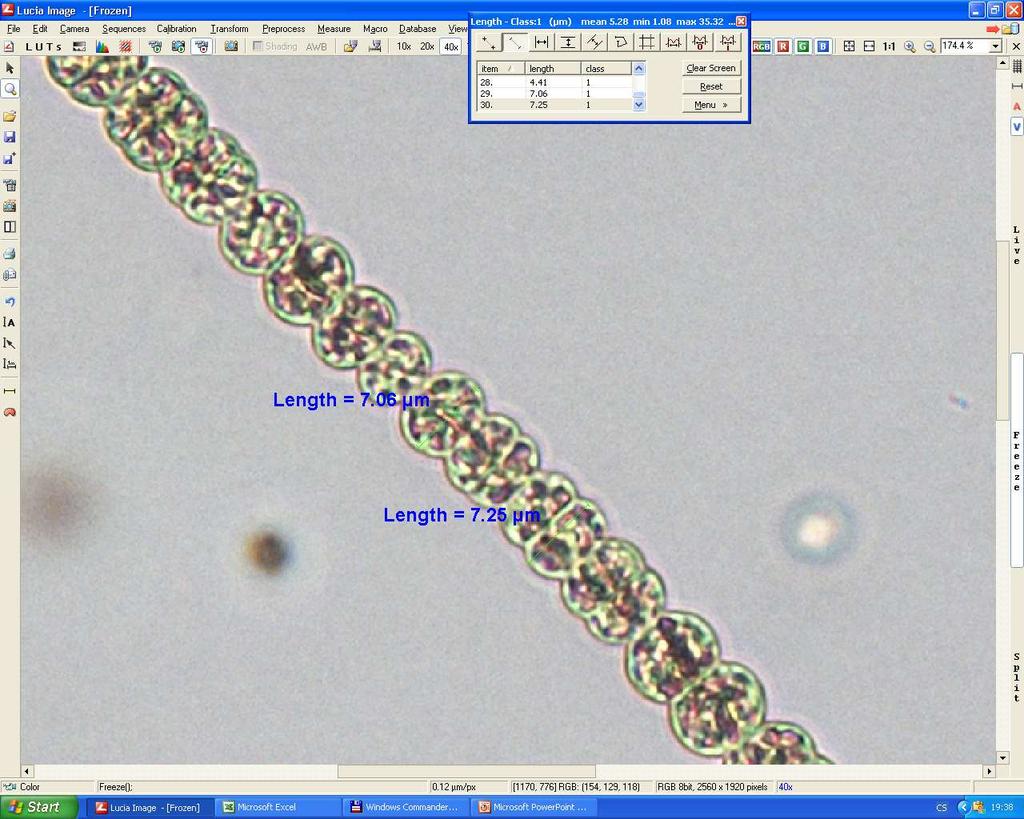 Anabaena