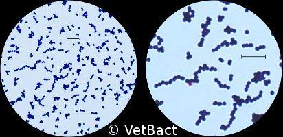 Obrázek 4: Gramovo barvení Streptococcus agalactiae na dvou různých zvětšeních. Délka měřítka je ekvivalentní 5 μm (VetBactBlog, 2011). 4.3 Kultivace 4.3.1 Selektivní bujon pro screening S.