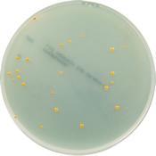 Obrázek 13: Streptococcus agalactiae, jiné