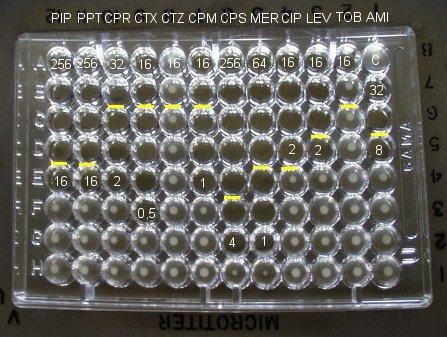 Obrázek 15: Diluční test (old.lf3.cuni.cz Diluční metoda) 5.3 E-test Tento test řádíme mezi kvantitativní testy stejně jako diluční test, ale je založen na podobném principu jako diskový difuzní test.