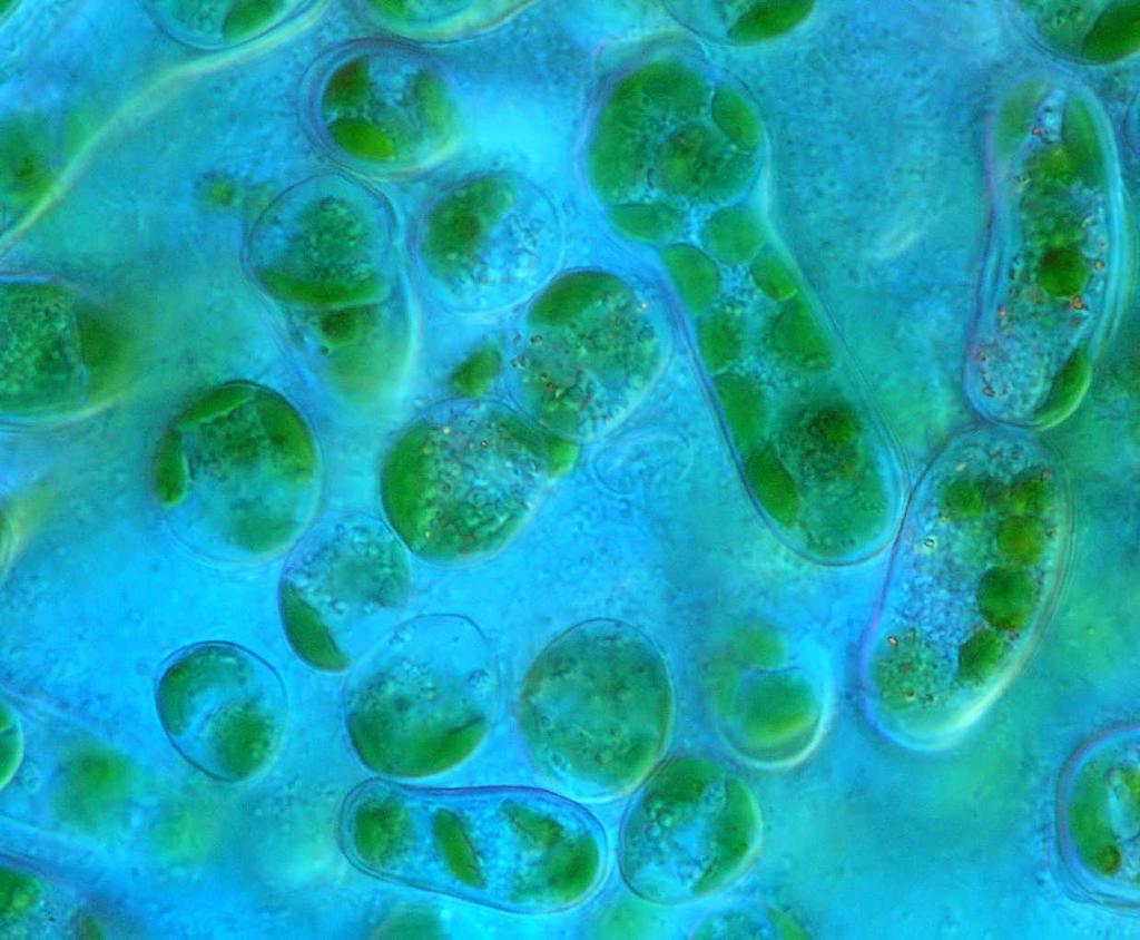 Bumilleriopsis filiformis (příprava preparátu z kultury) Kokální řasa, v buňkách početné chloroplasty, rozmnožování pomocí